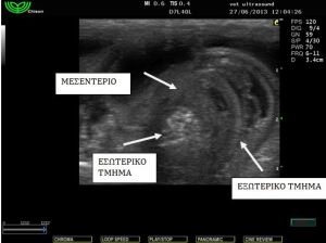 εγκολεασμός σε εγκάρσια τομή