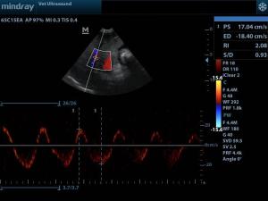 hepatic vein flow