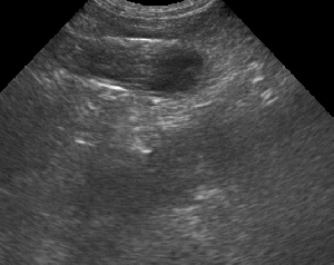 Aug 07, 2015 1157